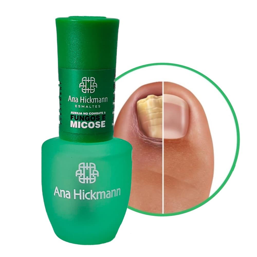 Esmalte Combatente de Fungos e Micoses Tratamento Melaleuca Help Ana Hickmann 9ml