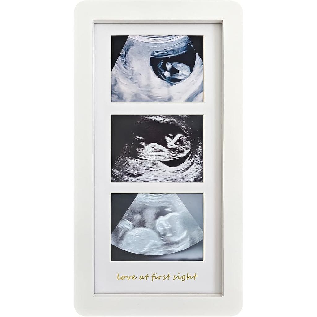 Porta-retratos de ultrassom com três imagens e frase 'amor à primeira vista'.